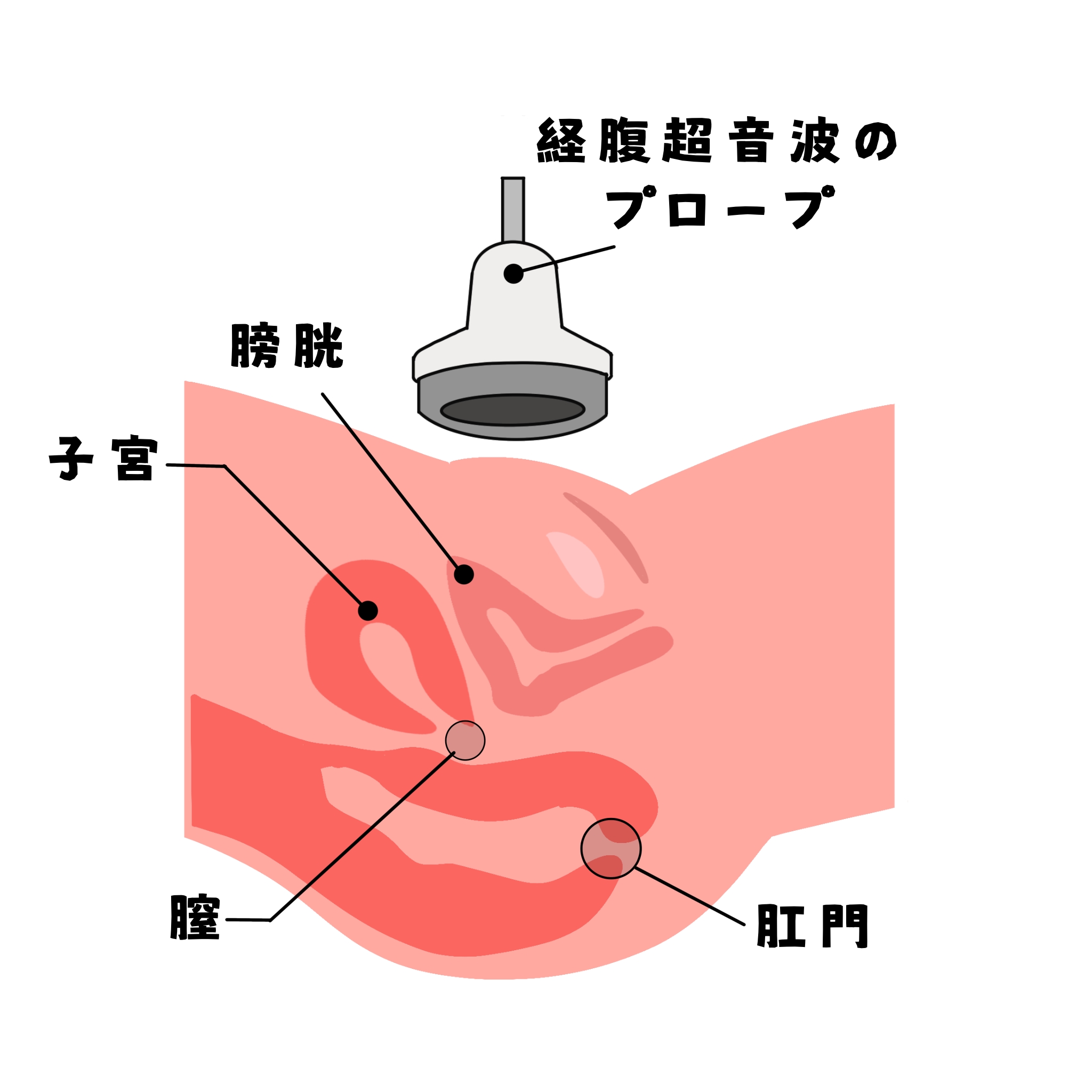 経腹超音波検査