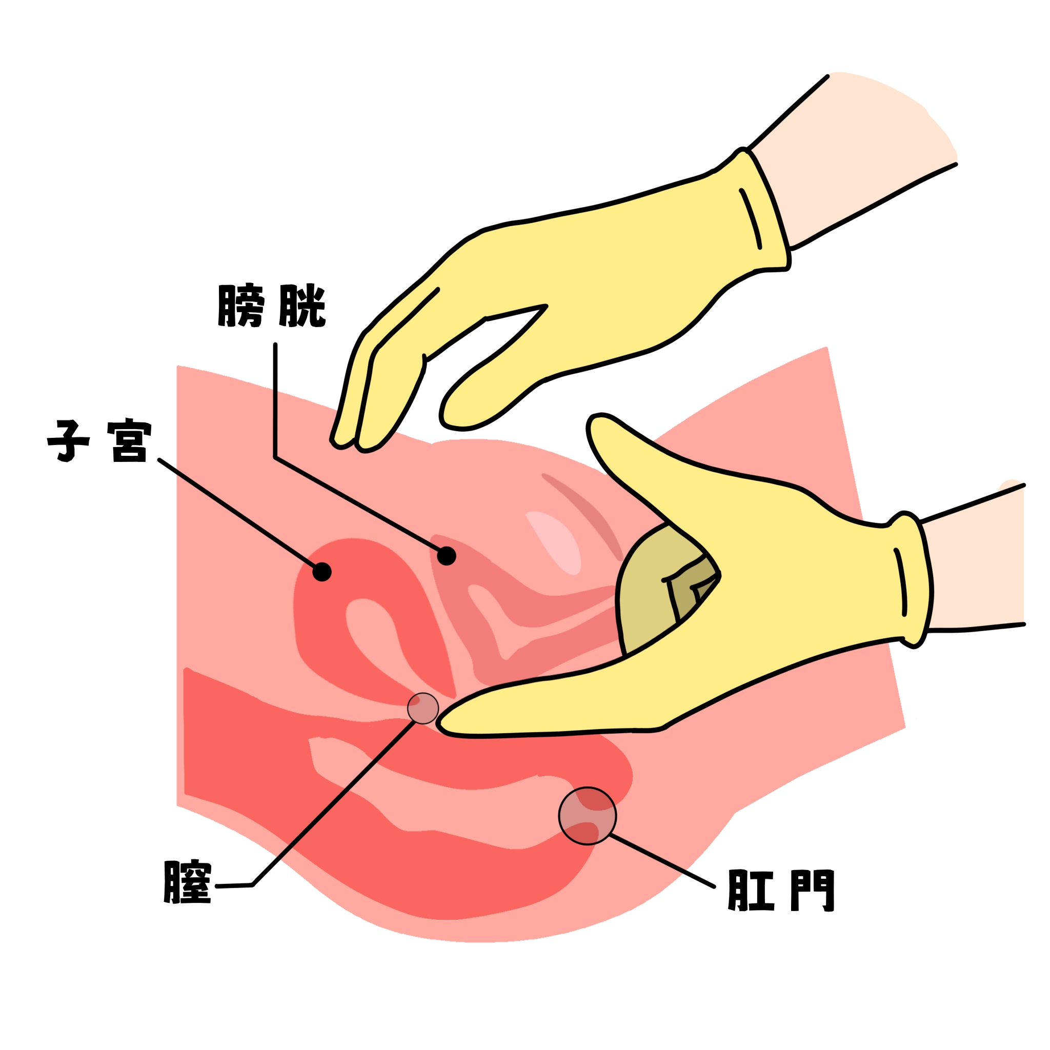 内診について